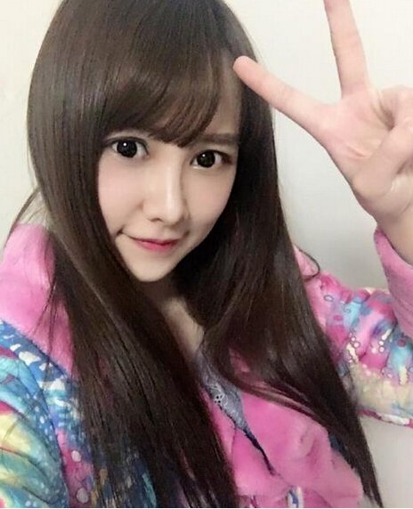 SNH48成员唐安琪意外烧伤 可爱私照图赏